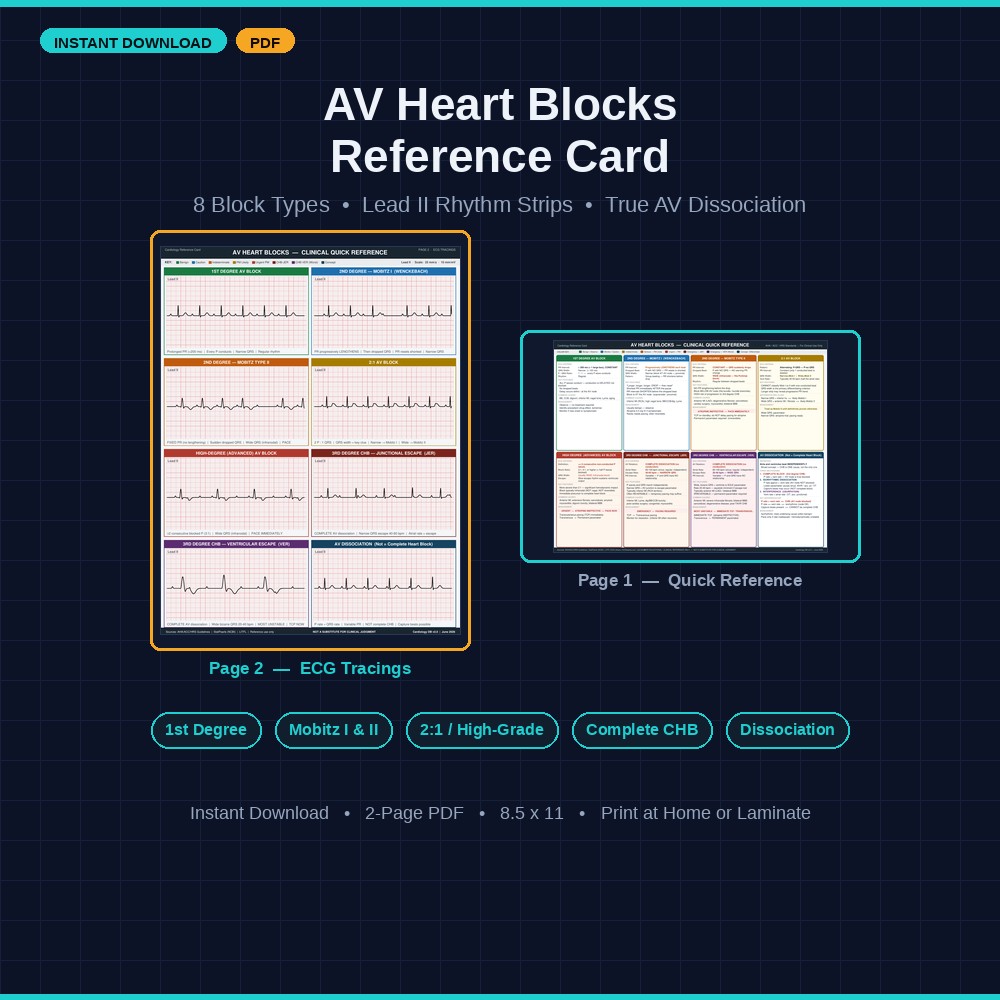 AV heart block rhythm-strip reference card