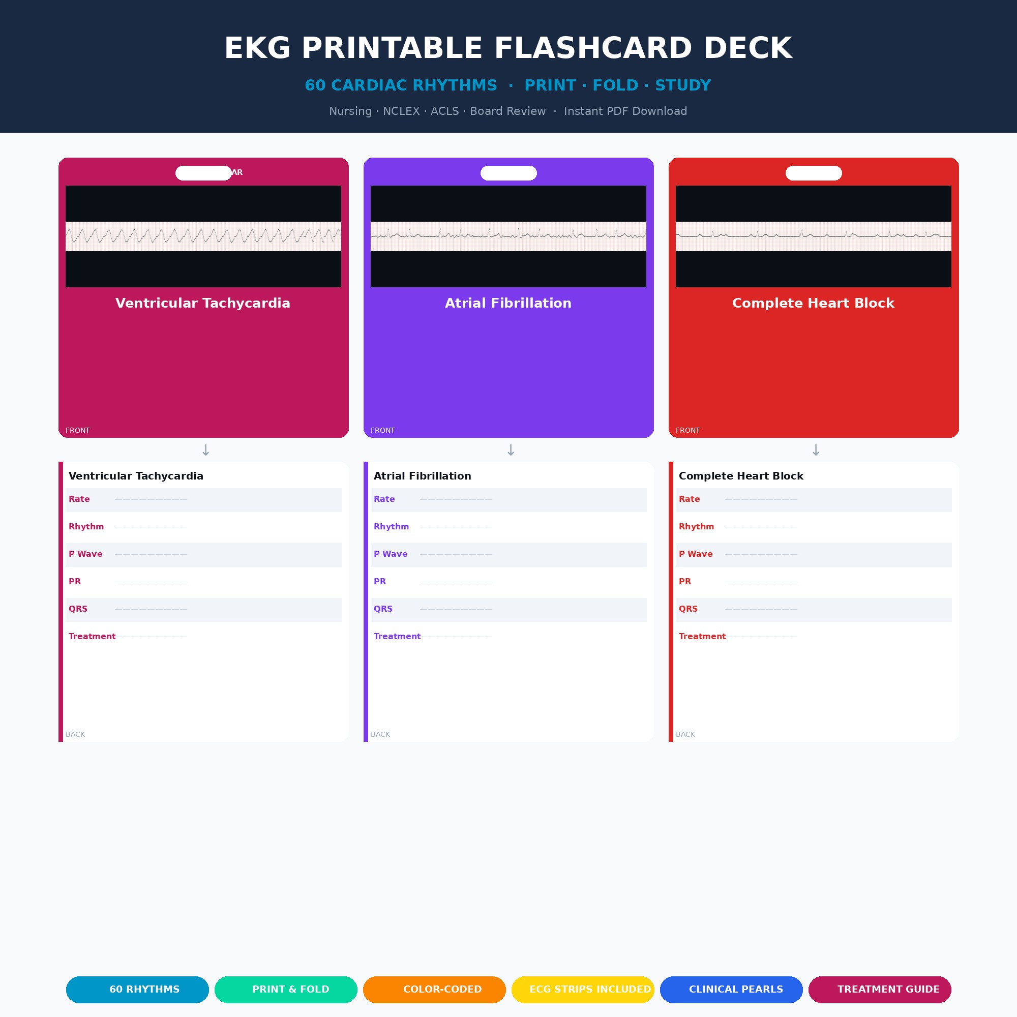 Interactive EKG rhythm flashcard study app