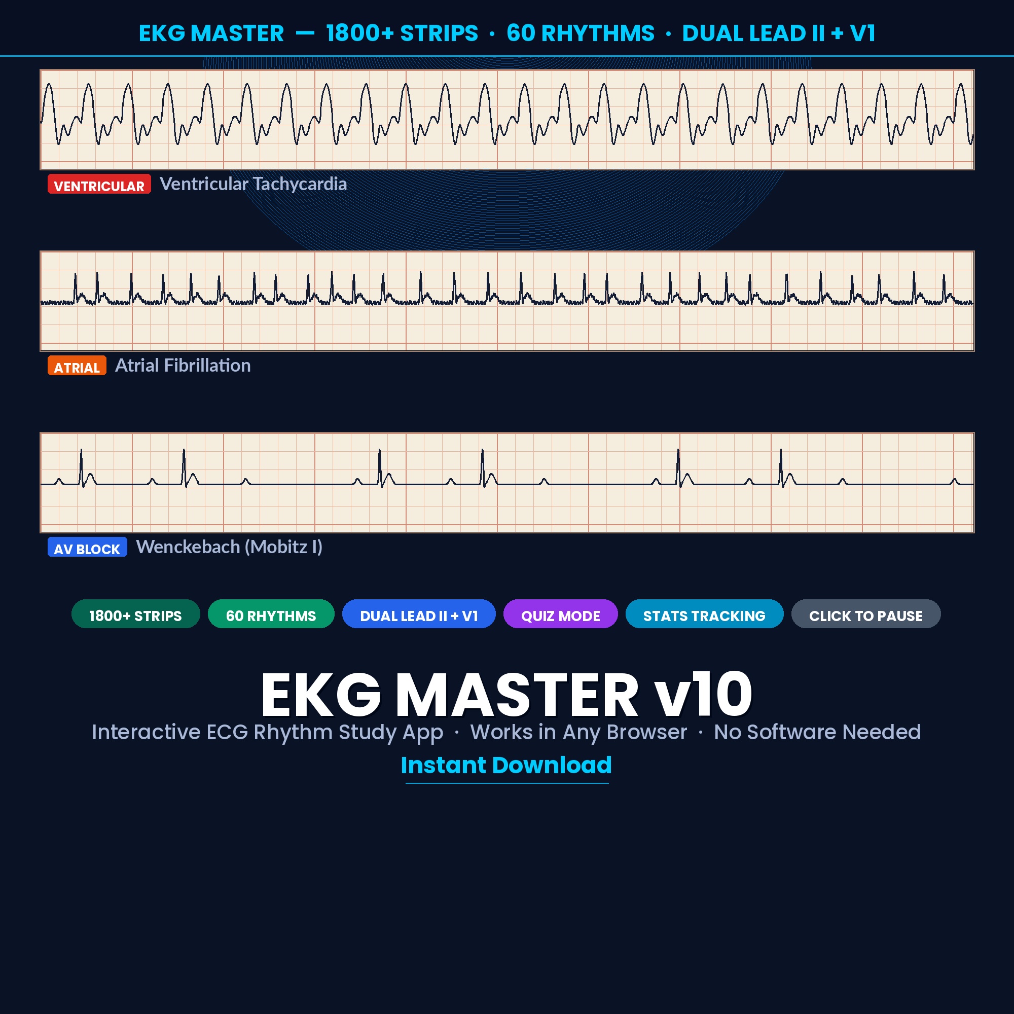 EKG Master v10 animated telemetry rhythm practice