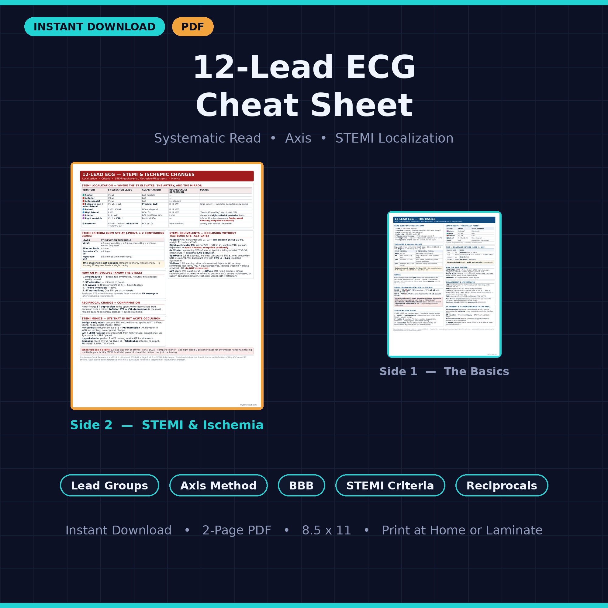 12-Lead ECG Cheat Sheet for systematic interpretation