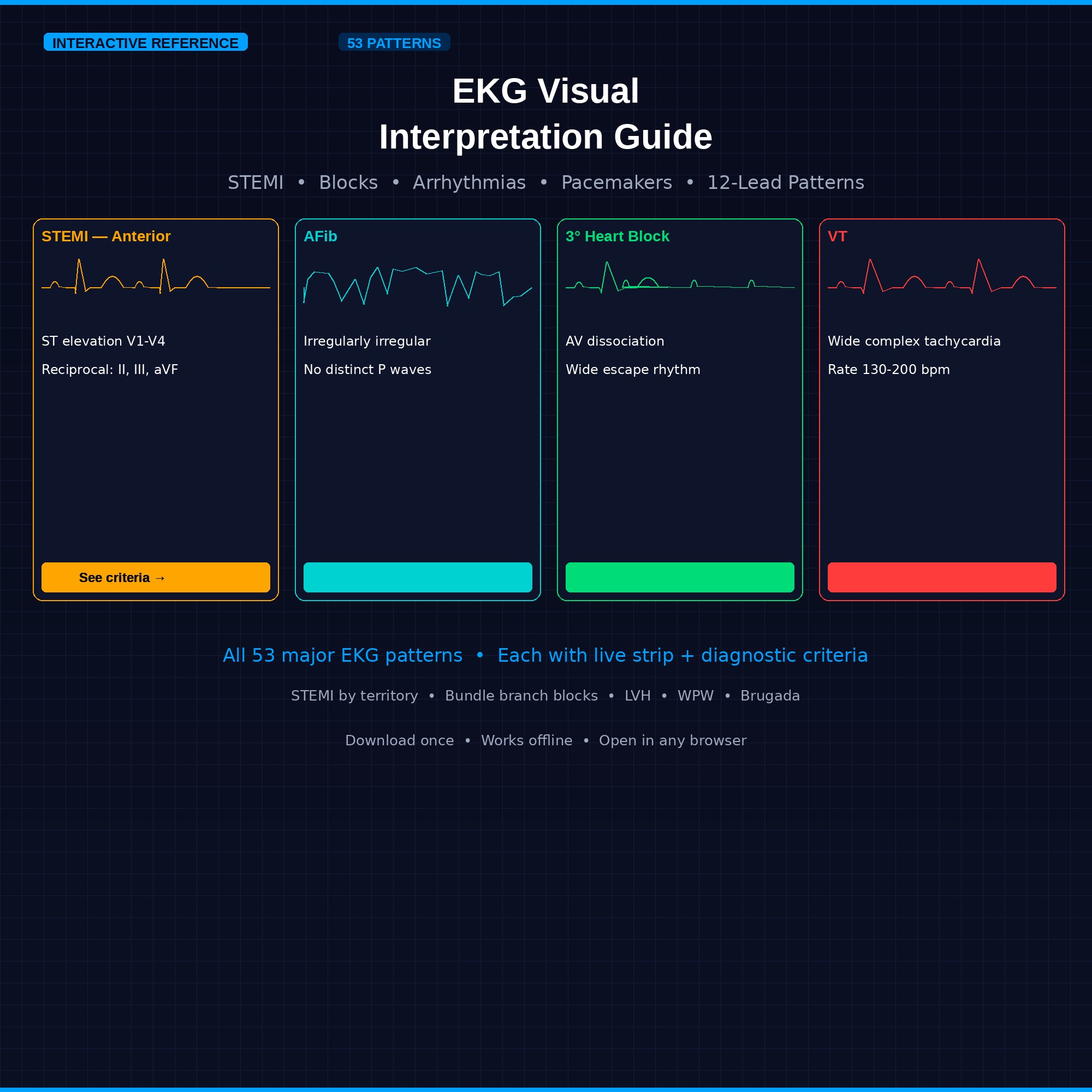 EKG Visual Interpretation Guide with animated waveform examples